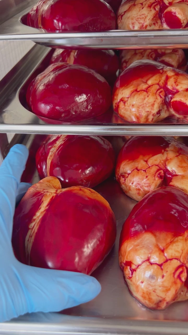 Chocolate Human Heart